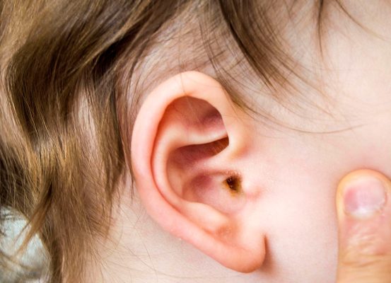 انواع بیماری های گوش و علل آن